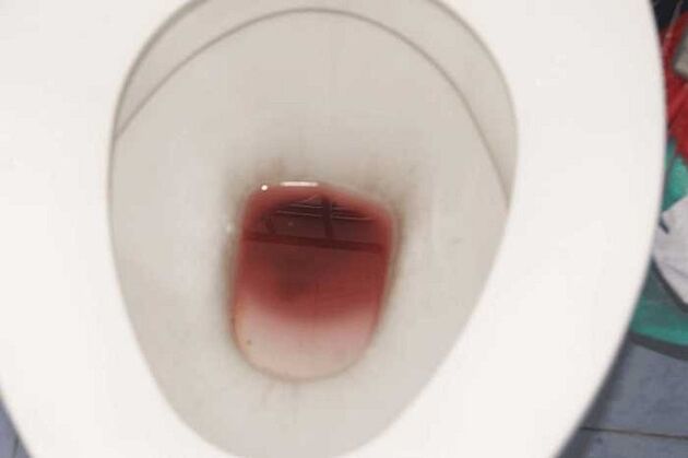 repérer chez les hommes lorsqu'ils sont excités